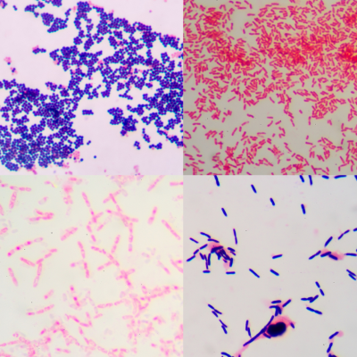 gram stain